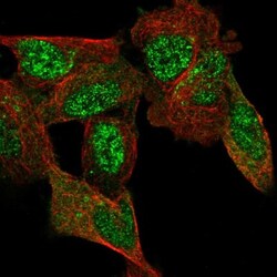 C11orf96 Antibody, Novus Biologicals 0.1mL; Unlabeled:Antibodies, Polyclonal